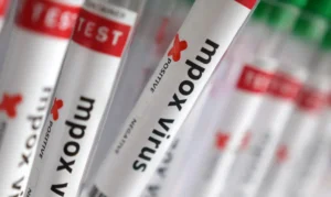 Sobe para 140 número de casos confirmados de Mpox no país, em 2026