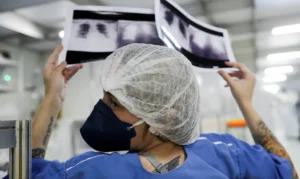 Diagnóstico tardio dá poucas chances de cura para o câncer de pulmão